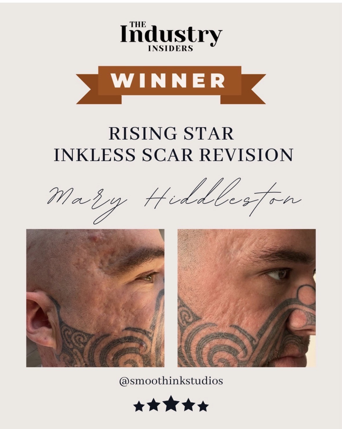 Award Winner