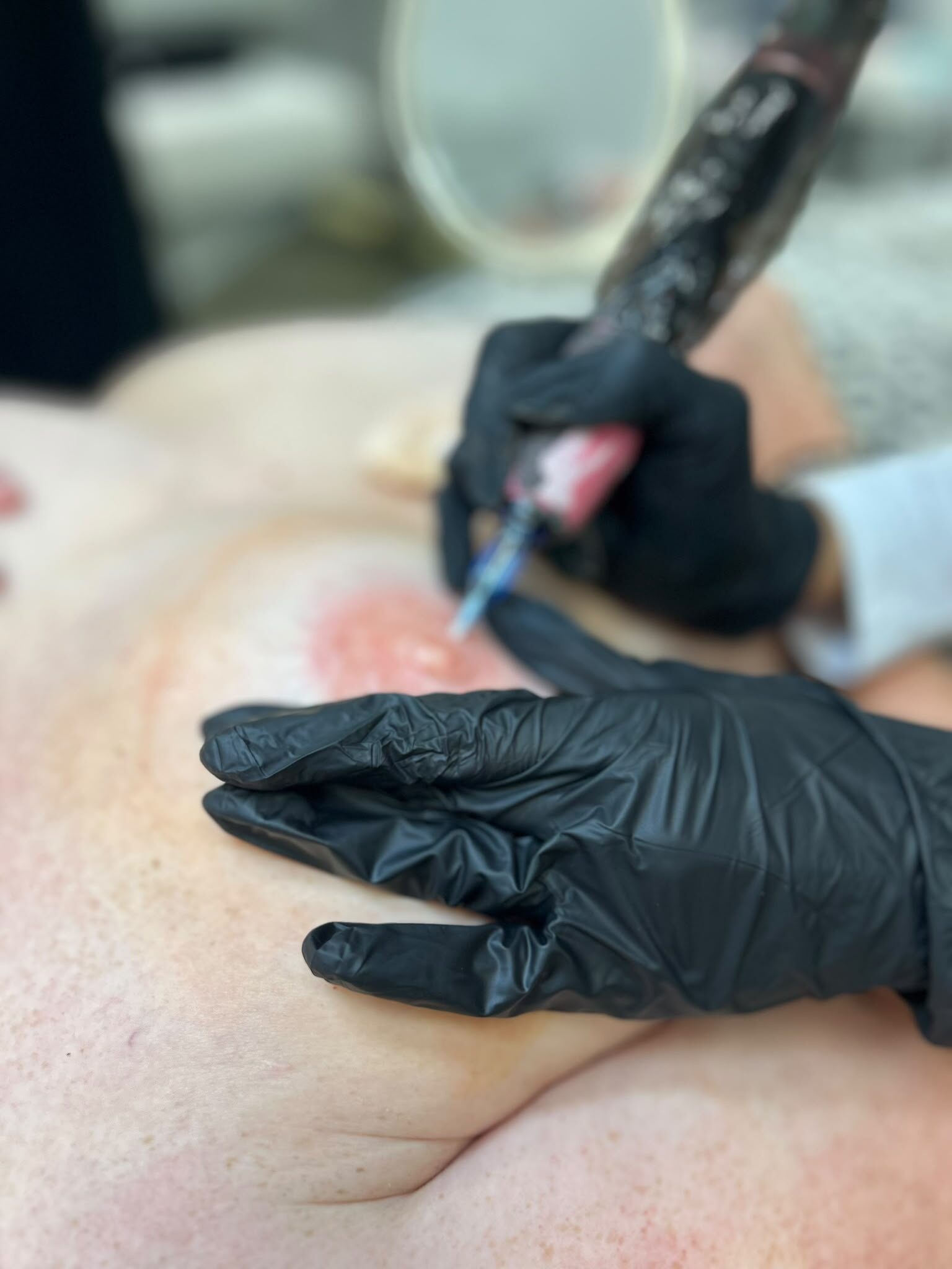 Nipple Restoration